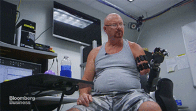 Prótesis Biónicas controlada por la mente