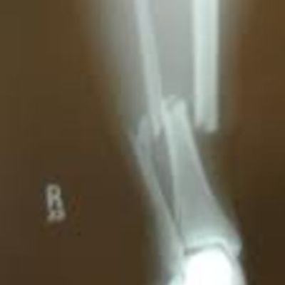 Timeline: Injuries, Injuries, Injuries