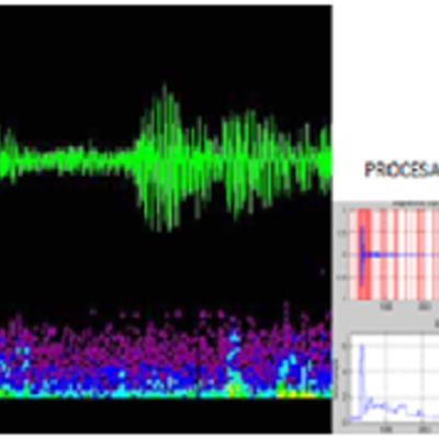 Timeline: HISTORIA DEL TRATAMIENTO DIGITAL DE LA VOZ