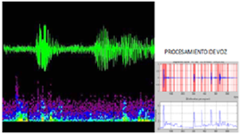 Timeline: HISTORIA DEL TRATAMIENTO DIGITAL DE LA VOZ