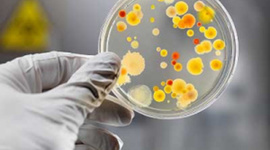 Timeline: Historia de la mirobiología