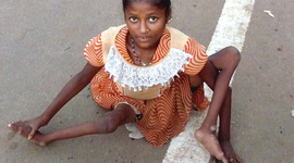 Timeline: U.S. HISTORY & POLIO