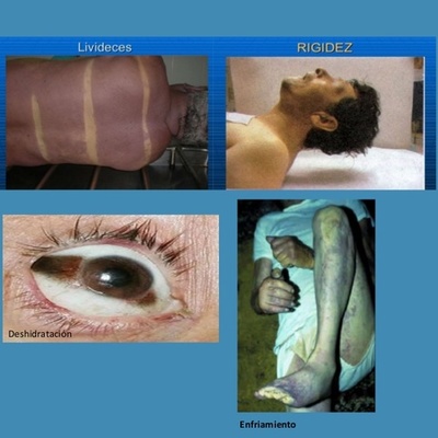 Timeline: FENOMENOS CADAVERICOS