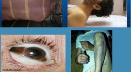 Timeline: FENOMENOS CADAVERICOS