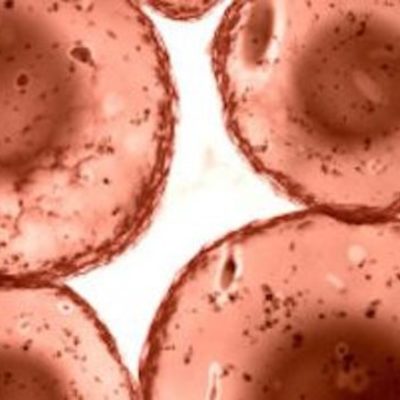 Timeline: Food Allergies