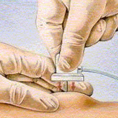 Timeline: parcours 4.4S5