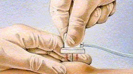 Timeline: parcours 4.4S5