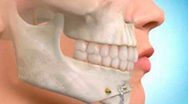 Timeline: Historia de la Oclusión