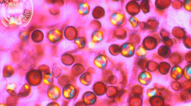 Timeline: Historia de la micologìa