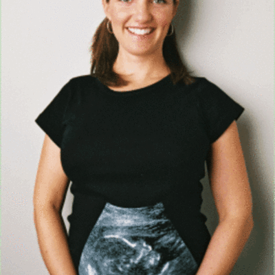 Timeline: Stages of Pregnancy