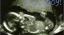 Timeline: From Conception To Birth