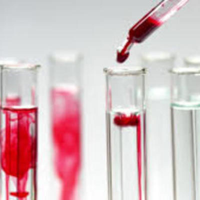 Timeline: Blood and Blood Spatter