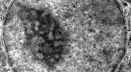 Timeline: La historia del microscopio/La historia de la celula