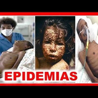 Timeline: DIEZ GRANDES EPIDEMIAS DE LA HUMANIDAD