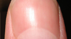 Timeline: The Freeway to Freedom