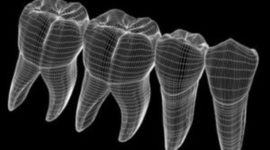 Timeline: Odontomática