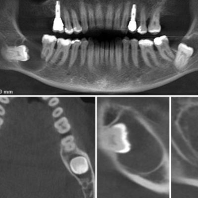 Timeline: Integración de los sistemas digitales en la practica odontologíca. Carlos Guillermo Barragán Díaz. Bioingenieria. CUCS.