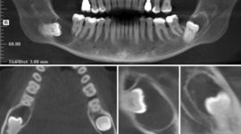 Timeline: Integración de los sistemas digitales en la practica odontologíca. Carlos Guillermo Barragán Díaz. Bioingenieria. CUCS.
