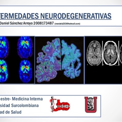 Timeline: ENFERMEDADES NEURODEGENERATIVAS CAUSADAS POR DEFICIENCIAS PROTEICAS