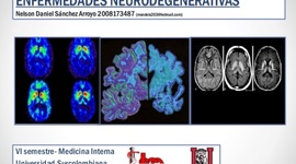 Timeline: ENFERMEDADES NEURODEGENERATIVAS CAUSADAS POR DEFICIENCIAS PROTEICAS