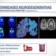 Enfermedades neurodegenerativas 1 638