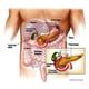 Cancer pancreatico