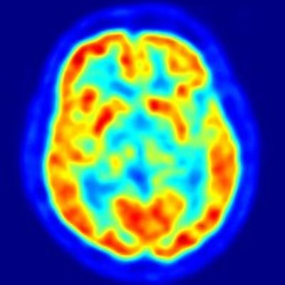 Timeline: PET History