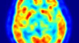 Timeline: PET History