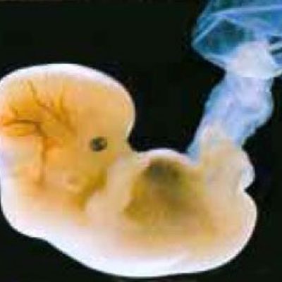 Timeline: Desarrollo embrionario del ojo ocular