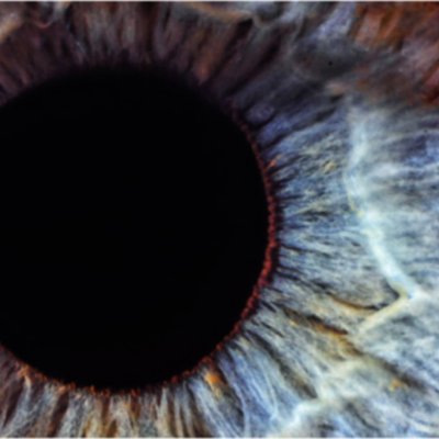 Timeline: EMBRIOLOGIA DEL  OJO HUMANO