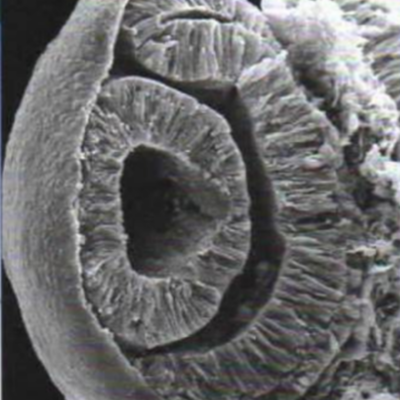 Timeline: DESARROLLO EMBRIOLOGICO DEL GLOBO OCULAR