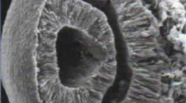 Timeline: DESARROLLO EMBRIOLOGICO DEL GLOBO OCULAR