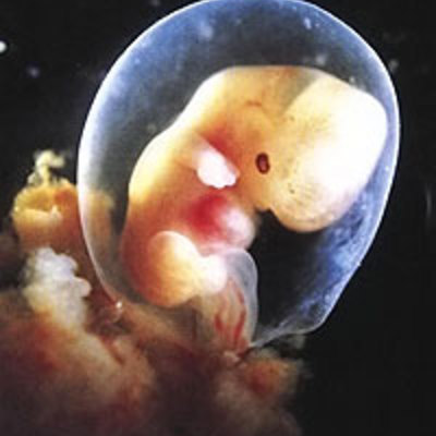 Timeline: DESARROLLO EMBRIOLÓGICO DEL OJO HUMANO.