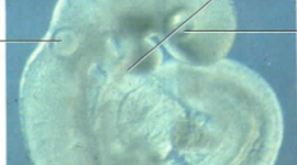 Timeline: Embriología del ojo humano