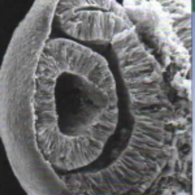 Timeline: Desarrollo del ojo humano