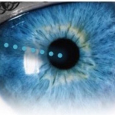 Timeline: Laser eye correction (LASIK - Laser-Assisted in Situ Keratomileusis)