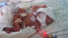 Timeline:  PARTO PREMATURO. CAUSAS, PREVENCIÓN Y MANEJO.