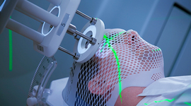 Timeline: Radiation Therapy