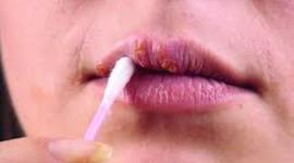 Timeline: PAPIL.LOMA HUMÁ