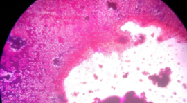 Timeline: Microbiología del siglo