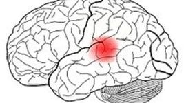 Timeline: Historia de la Neuropsicología