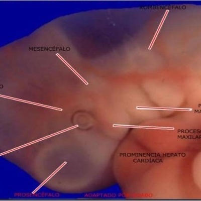 Timeline: DESARROLLO EMBRIONARIO DEL SISTEMA VISUAL