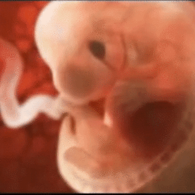 Timeline: DESARROLLO EMBRIONARIO DEL OJO