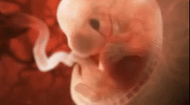 Timeline: DESARROLLO EMBRIONARIO DEL OJO