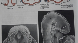 Timeline: La primera manifestación del desarrollo del ojo aparece en el embrión de 22 días en forma de 2 surcos poco profundos a cada lado del cerebro anterior al cerrarse el tubo neural, este surco produce evaginaciones del cerebro anterior las vesículas ópticas