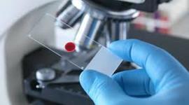 Timeline: 1882 la ciencia desarrollada en la UW permite clases de toxologia