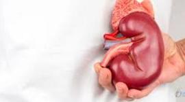 Timeline: Años 70. Se realiza el primer trasplante renal de América Latina.