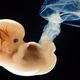 Six week old human embryo