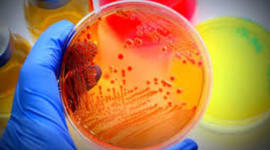 Timeline: Historia de la microbiología