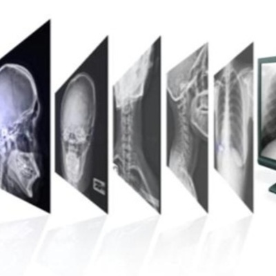 Timeline: EVOLUCIÓN DE LA RADIOLOGÍA
